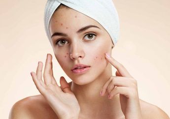 6 Bahan Alami yang Dapat Mengobati Jerawat di Permukaan Wajah, Ampuh!