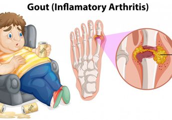 Ini 5 Jenis Makanan yang Pantang Dikonsumsi oleh Penderita Asam Urat