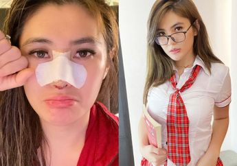 Usai Operasi Hidung dari Endorse, Wajah Bengkak Angela Lee Curi Perhatian Netizen: 'Aduh Ngilu'