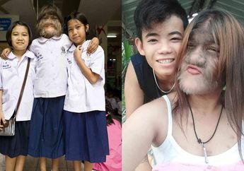 Wajahnya Dipenuhi Bulu Lebat Bak Manusia Serigala, Begini Rupa Asli Gadis ini Saat Semua Bulunya Dicukur!