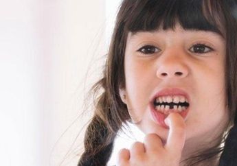 Waspada! Arti Mimpi Gigi Copot Bisa Jadi Pertanda Buruk, Mulai dari Finansial, Pekerjaan Hingga Ditinggal Seseorang