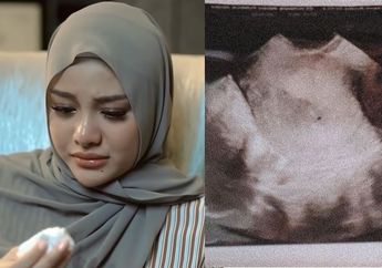 Aurel Hermansyah Jadi Sorotan, Ini Tips Dokter untuk Ibu yang Ingin Jalani Program Kehamilan Usai Keguguran