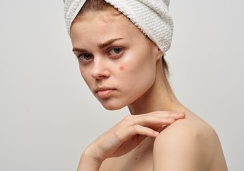 Ini Dia Penyebab Timbulnya Jerawat di Pipi Selain Faktor Genetik, Simak!