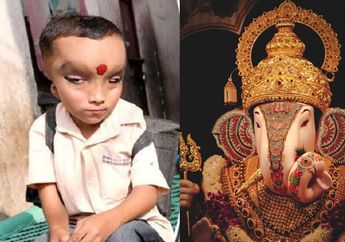 Lahir dengan Kondisi Fisik Tak Biasa, Anak Kecil di India ini Justru Dipuja karena Dianggap Sebagai Titisan Dewa Ganesha