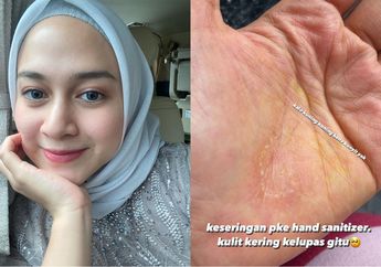 Belajar dari Nina Zatulini yang Alami Iritasi Kulit Akibat Hand Sanitizer Berlebihan, Berikut 3 Cara Mudah Cegah Kulit Kering Akibat Pembersih Tangan