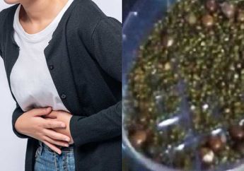 Seumur Hidup Tidak Pernah Sarapan dan Malas Minum Air Putih, Dokter Kaget Saat Belah Organ Wanita ini, Ratusan Benda Asing Ada di Dalamnya