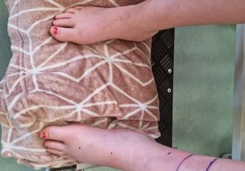 Sepelekan Anaknya yang Mengeluh Sakit, Ayah ini Menyesal Setelah Lihat Kaki Anaknya Membengkak 3 Kali Lipat, Dokter Syok Saat Tahu Penyebabnya!