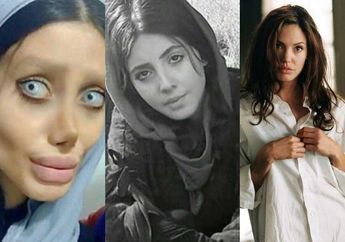 Demi Mirip Angelina Jolie, Fans Ini Lakukan 50 Kali Operasi Plastik Hingga Kabarkan Lehernya Patah, Begini Penampakannya