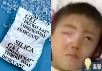 Peringatan! Seorang Anak Alami Kejadian Mengerikan Pada Matanya Setelah Bermain dengan Silica Gel, Dampaknya Sebabkan Kerusakan Permanen