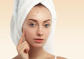 4 Rekomendasi Obat Jerawat Murah di Bawah Rp50 Ribu, Bye-bye Jerawat Membandel!