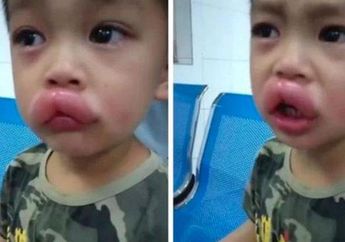 Bikin Syok Berat! Bocil Iseng Comot Makanan di Kulkas, 10 Menit Berlalu Justru Nangis Kejer Saat Bibirnya Mendadak Bengkak Parah, Faktanya Diungkap sang Ayah