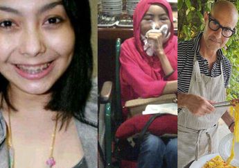 Jika Artis Indonesia Ini Wajahnya Sampai Berubah Drastis dan Akhirnya Wafat karena Kanker Lidah, Artis Hollywood Ini Berhasil Melawan Penyakit Serupa