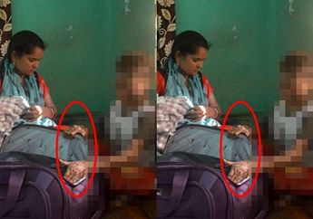 Terlahir Dengan Kulit Mirip Ular, Bocah 16 Tahun Alami Kondisi Langka hingga Harus Lakukan Hal Ini Tiap 3 Jam Sekali, Begini Kisah Pilu sang Ibu Ratapi Kondisi Buah Hatinya