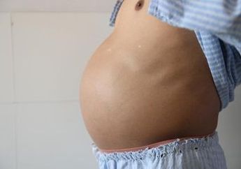 Perut Pria Ini Membesar Secara Misterius Bak Wanita Hamil, Ketika Dibedah Isinya Mengerikan, Dokter Sebut Terbesar Sepanjang Pengalaman