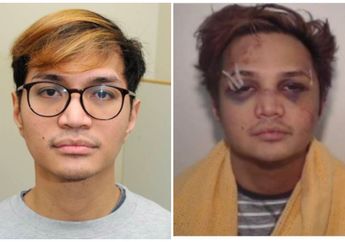 Beredar Foto Reynhard Sinaga Babak Belur, Begini Kilas Balik Kasus sang Predator Seksual yang Sangat Berbahaya hingga Disebut Psikopat!