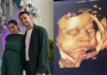 Setelah Calon Buah Hatinya Disebut Memiliki Ukuran Kecil, Nagita Slavina Mendadak Curcol dengan Zaskia Sungkar, Istri Raffi Ahmad Alami Hal ini di Trimester Akhir Kehamilan!