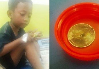 Bocah 6 Tahun di Brebes Tak Sengaja Telan Uang Koin sampai Lemas Selama Sebulan, Penderitaan sang Anak Berakhir Usai Uang Koin Berhasil Dikeluarkan dengan Cara Ini