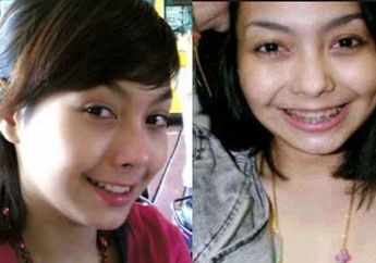 Dulu Artis FTV Ini Tutup Usia Setelah Digerogoti Kanker Lidah, Ternyata Santap Makanan Jenis Ini Bisa Jadi Pemicunya, Simak Gejalanya!