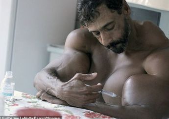 Terobsesi dengan Otot Kekar, Pria Ini Suntikkan Minyak ke Tubuhnya, Kini Penampilannya Mirip Hulk