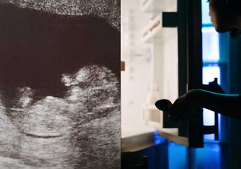 Nekat Simpan Bayinya Dalam Kulkas, Kondisi Anak Wanita Ini Menyayat Hati hingga Terkuak Fakta Mengharukan di Balik Tindakannya