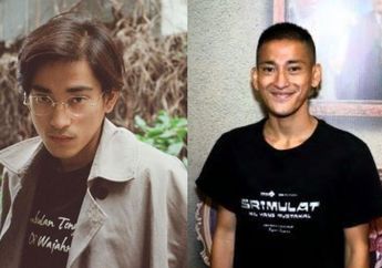 Tubuhnya Kurus Kering sampai Kepalanya Botak, Artis Bio One Disangka Konsumsi Narkoba Gegara Penampilan Terbarunya, Ternyata Ini Fakta Sesungguhnya