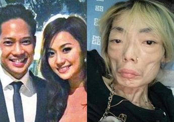 Niat Hati Nikahi Konglomerat Biar Hidup Makmur, Aktris Cantik Ini Harus Telan Pil Pahit Setelah Digerogoti Penyakit Mengerikan Ini, Begini Penampilannya Sekarang 