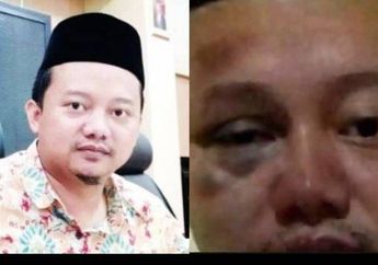 Beredar Foto Herry Wirawan Babak Belur Dihantam Para Penghuni Tahanan, Begini Tanggapan Pihak Berwajib Soal Kondisi Pelaku Pelecehan Puluhan Santri Tersebut