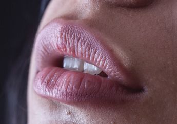 Impian Punya Bibir Merah Merona dan Sehat Sekarang Mudah Digapai, Tinggal Terapkan Cara-Cara Ini, Paling Penting Hal Ini Jangan Dilupakan!