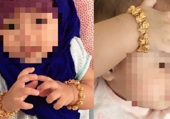 Menyesal Bukan Main! Nekat 3 Bulan Tak Melepas Gelang Emas yang Dipakaikan ke Bayi Perempuannya, Wanita Ini Ingatkan Para Ibu Agar Tak Melakukan Hal yang Sama