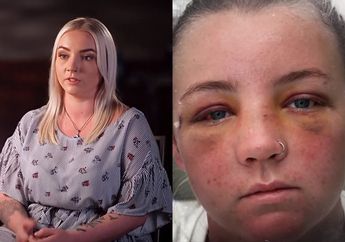 Gadis Backpacker Diculik Anggota Geng Motor dan Dijadikan Budak Pemuas Nafsu, Wajahnya Babak Belur Hingga Matanya Nyaris Dicongkel