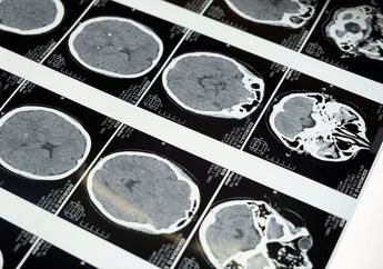 Sebanyak 20 Persen Darah dalam Tubuh Selalu Dialirkan ke Otak, Ini 5 Fakta Menarik Otak Manusia