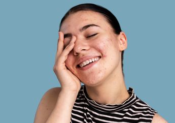 Deretan Produk Krim Penghilang Bekas Jerawat yang Bisa Bikin Wajah Auto Mulus!