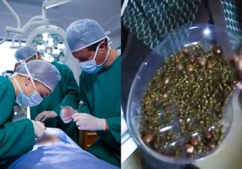 Akibat Jarang Sarapan, Dokter Keluarkan 2000 Benda Asing yang Bersarang di Perut Wanita ini