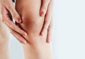 Nggak Perlu Perawatan Mahal, Dengkul yang Hitam Bisa Cerah Cuma dengan Satu Bahan Dapur Ini, Hasilnya Bikin Melongo!