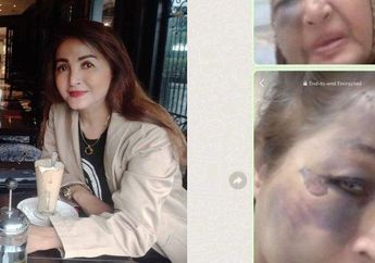 Nelangsanya Nasib Artis Kawakan Ngetop di Era 80-an Ini, Dulu Pernikahannya dengan Menteri Zaman Soeharto Tak Diakui, Kini Jadi Korban Tabrak Lari Sampai Kepalanya Retak