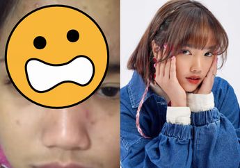 Fuji Bangga Pamer Fojo Jadul dengan Wajah Kusam dan Jerawatan, Netizen: Tetep Cantik