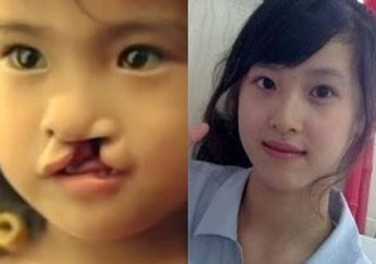 Tak Terima Bayinya Terlahir dengan Bibir Sumbing, Suami Istri Tega Buang Bayi di Pinggir Jalan, Begini Pembalasan sang Anak Usai 20 Tahun Berlalu