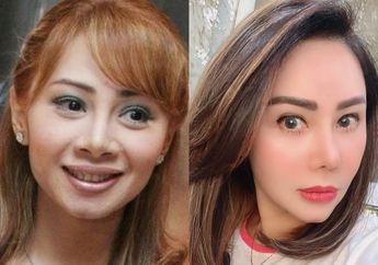 Geram Karena Sering Dituding Oplas Seluruh Bagian Wajah, Femmy Permatasari: Mata, Dagu, Semua ya Asli!