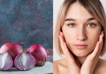 Bukan Bahan Buat Tumisan! Siapkan Bawang Merah Malah Bisa Jadi Pengganti Skincare Mahal Atasi Flek Hitam, Nyesel Banget Baru Tahu