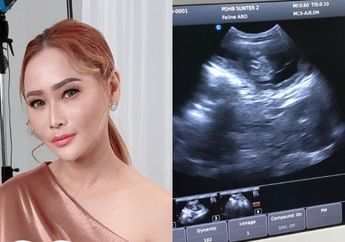 Dulu Butuh 13 Tahun Demi Dapat Momongan, Inul Daratista Mendadak Pamer Hasil USG, sang Biduan Umumkan Kabar Gembira: Alhamdulillah, Menanti Baby M