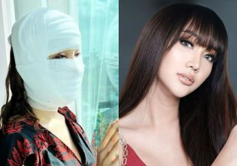 Namanya Sempat Nangkring di Puncak Trending Topik Twitter Pasca Operasi 'Ganti Kepala' di Korea Selatan, Inilah Arti Nama Lucinta Luna