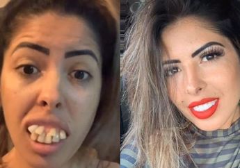 Glow Up Usai Mengaku Dinikahi Ahli Bedah Gigi, Perubahan Drastis Wanita ini Viral Hingga Terungkap Fakta Dibaliknya