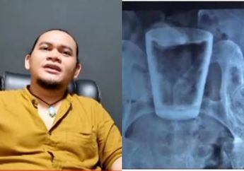 Gelas Kaca Bersarang di Perut Pria Asal Jember hingga Bikin Dokter Geleng Kepala, Mbah Mijan Turun Gunung Singgung Soal Santet Salah Sasaran!