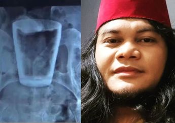 Heboh Gelas Kaca Bersarang di Dalam Perut Pria Sampai Dokter Kebingungan, Mbah Mijan Buka Suara dan Singgung Soal Masa Lalunya: 7 Tahun Lalu, Mbah Juga...