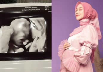 Akhirnya Terbongkar! Inilah Bocoran Nama Calon Anak Pertama Ria Ricis dan Teuku Ryan, Bakal Berbau Unsur Aceh dan Youtube