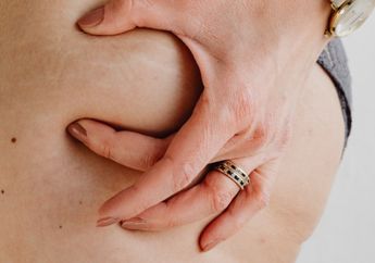 Nggak Pede Tampil Seksi Gegara Stretch Mark? Tak Perlu Galau, Coba Gunakan 5 Bahan Ini untuk Memudarkannya