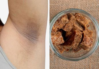 Sakit Hati Sudah Beli Krim Mahal Gak Berubah Juga, Padahal Cukup Pakai Racikan Gula Merah Bisa Bikin Ketiak Hitam Jadi Cerah dalam Waktu Singkat, Catat Caranya