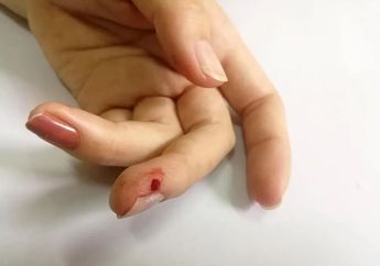 Arti Mimpi Tertusuk Benda Tajam Punya Makna Beragam Tergantung Area yang Terluka, Begini Penjelasannya