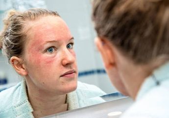 Catat! Ini 2 Tanda Kulit Tidak Cocok dengan Skincare Baru, Lama-lama Bisa Merah hingga Bengkak