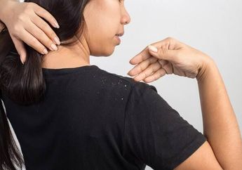 Arti Mimpi Membersihkan Ketombe di Rambut, Jangan Dianggap Sepele Ternyata Jadi Pertanda Baik Ini Lho, Simak Penjelasannya